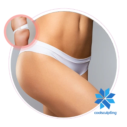 Coolsculpting en marbella - Elegant Clinic Banús