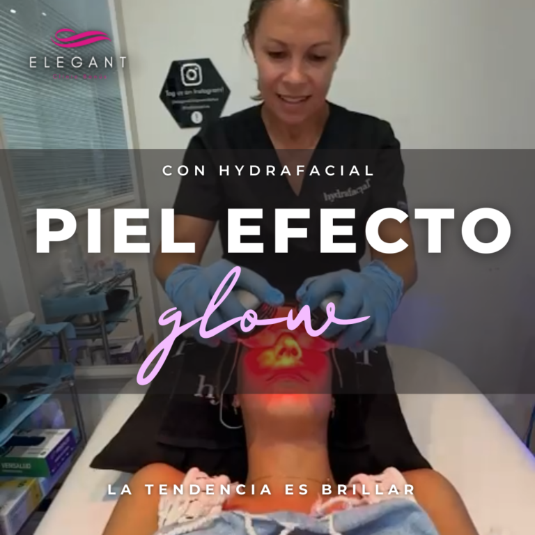 Piel efecto glow - neuromodulador con hydrafacial - Elegant Clinic Banús