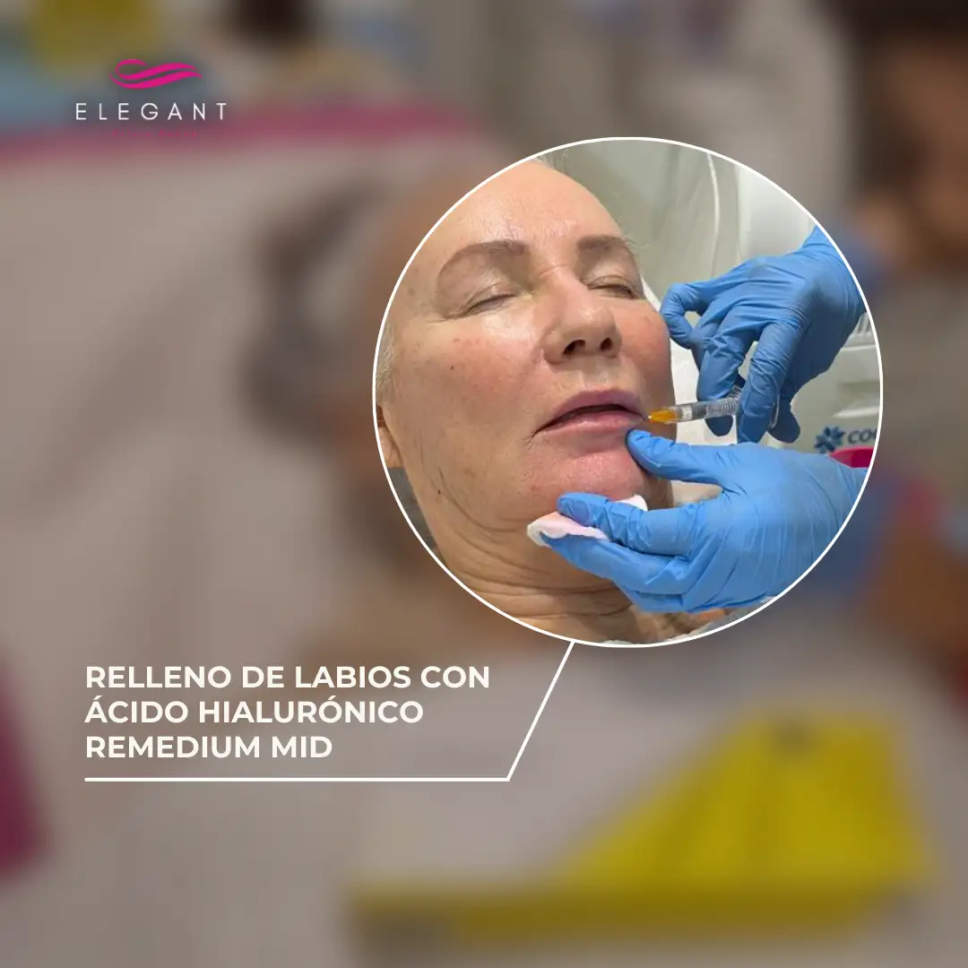 DEC TREATMENT - Elegant Clinic Banús