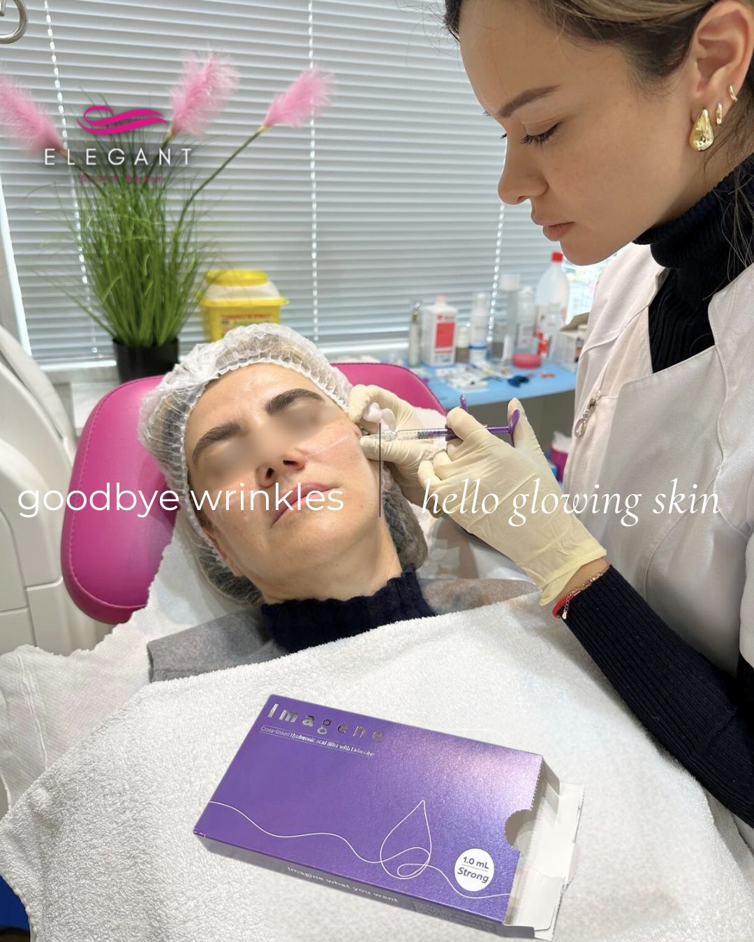 Relleno de pómulos con ácido hialurónico IMAGINE STRONG en Elegant Clinic Banús