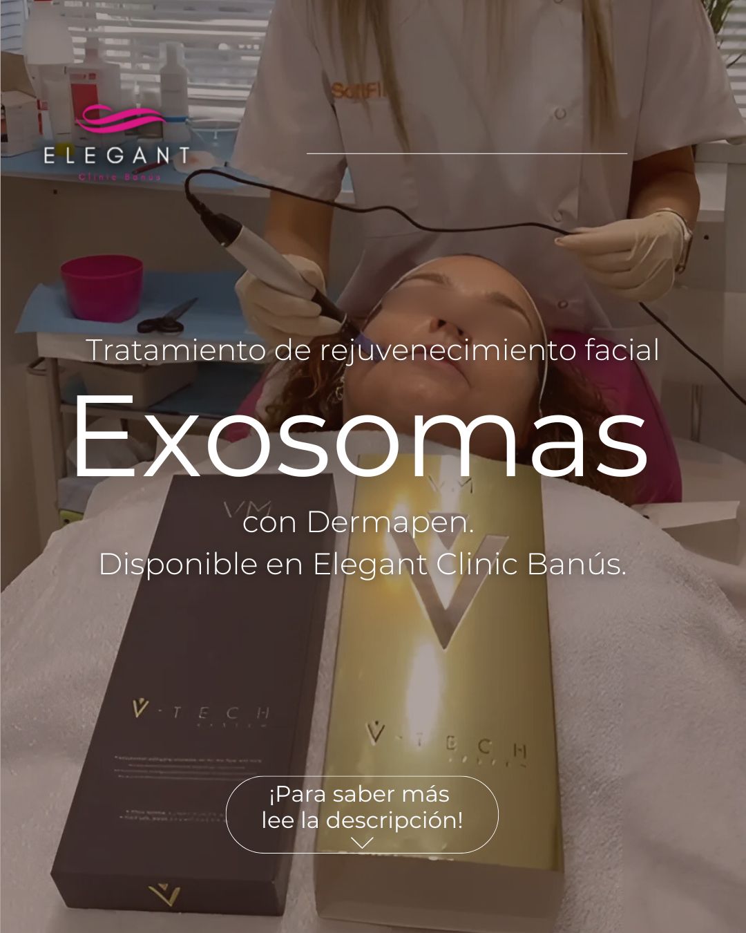 Exosomas con dermapen en Elegant Clinic Banús