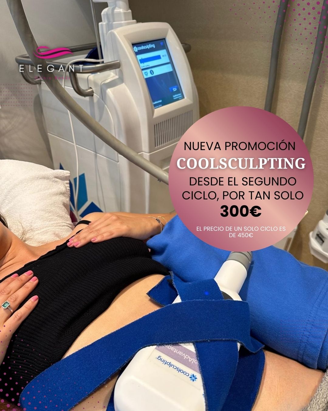 Coolsculpting en Elegant Clinic Banus