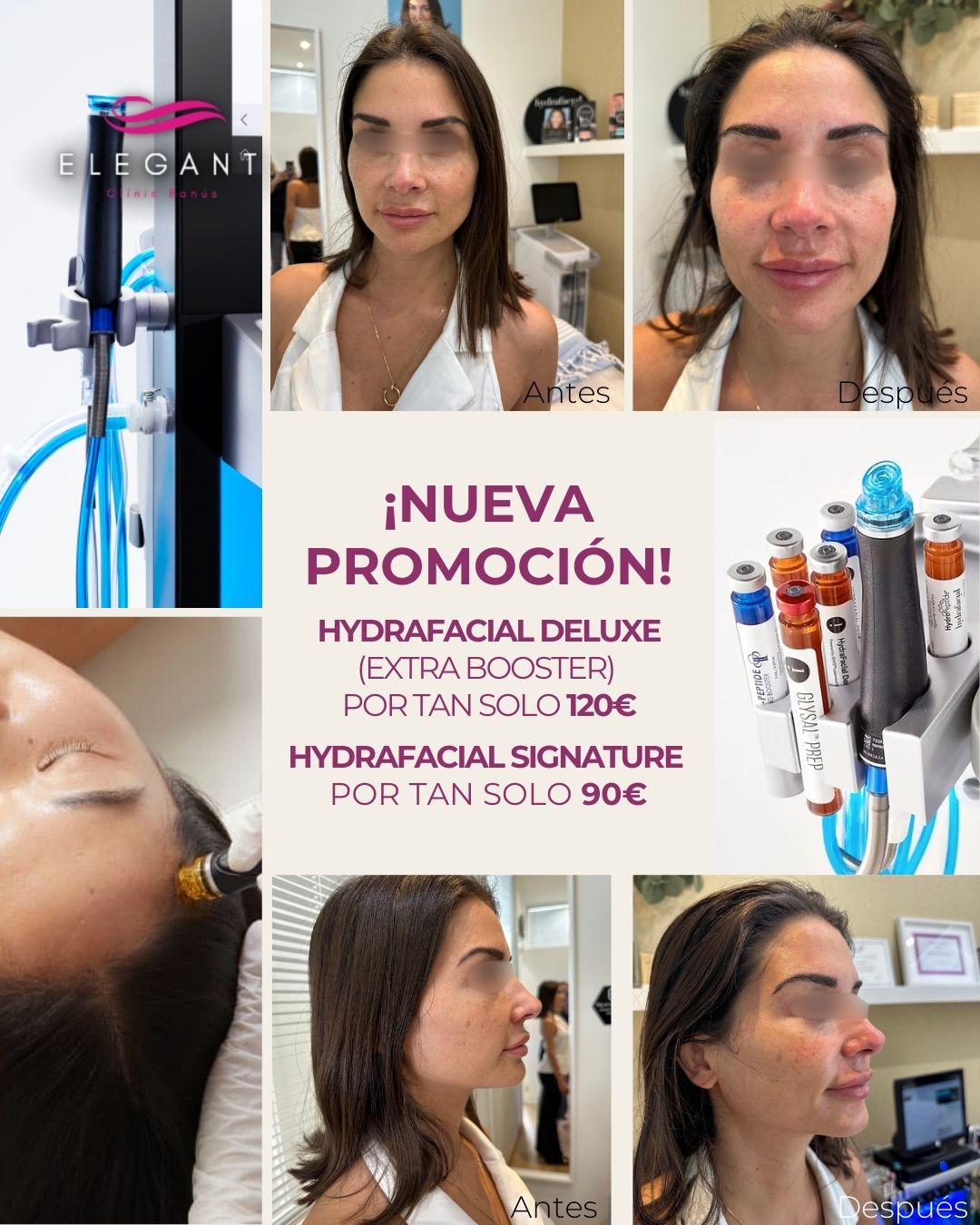 Hydrafacial en Marbella Elegant Clinic Banús